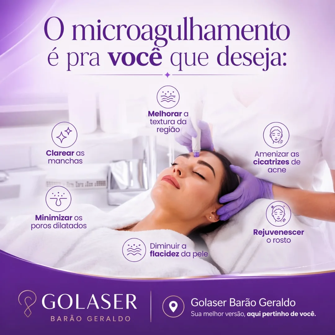 Conteúdo do Instagram GoLaser 1